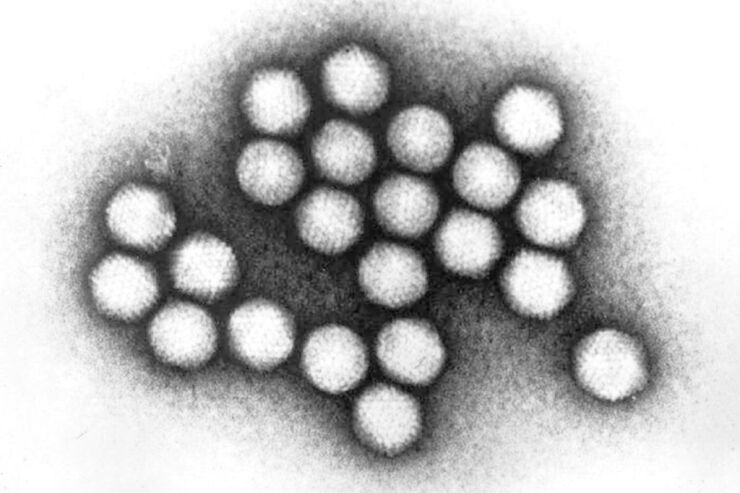 Cases expand: Multi-country outbreak of hepatitis in children