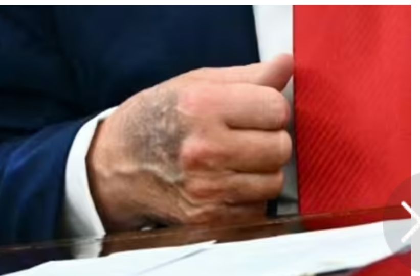 Black-and-blue Donald