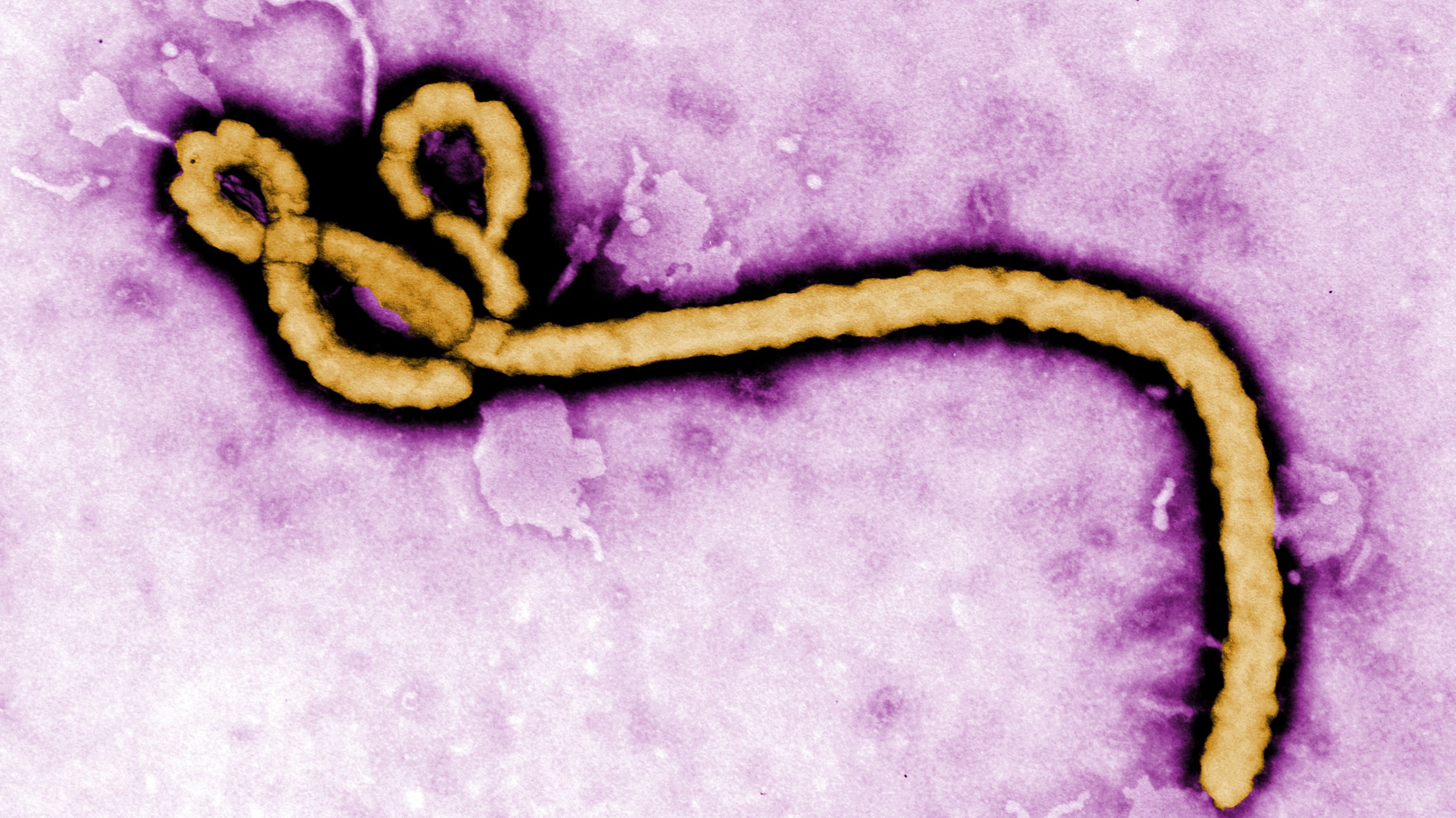 Ebola tells hantavirus, ‘hold my beer’